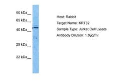 KRTHA2 Antibody, Novus Biologicals 100 &mu;L; Unconjugated:Antibodies,